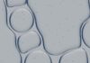 NMNの摂取、及び視床下部と脂肪細胞の連鎖反応について Abstract pattern of liquid bubbles with small particles.