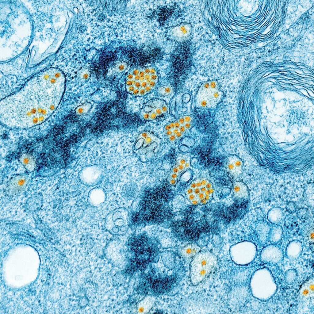 a blue and yellow substance with yellow dots