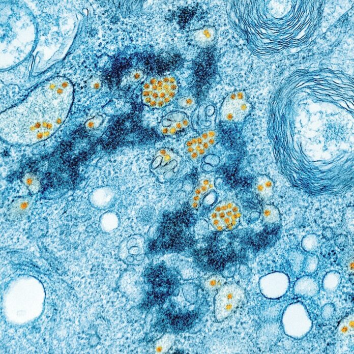 a blue and yellow substance with yellow dots